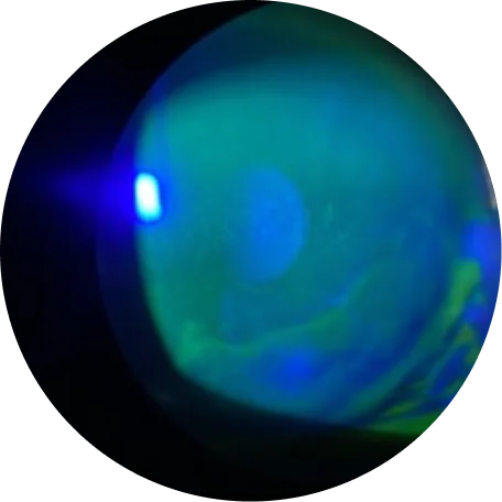 BASELINE, OS
